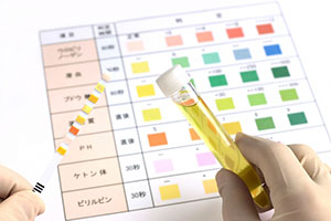 腎機能や消化管出血などを調べる検査