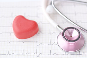 心臓の筋肉に流れる電流を体表面から記録する検査