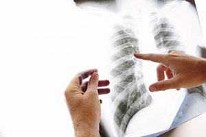 肺の病気や骨折などの検査を行う装置